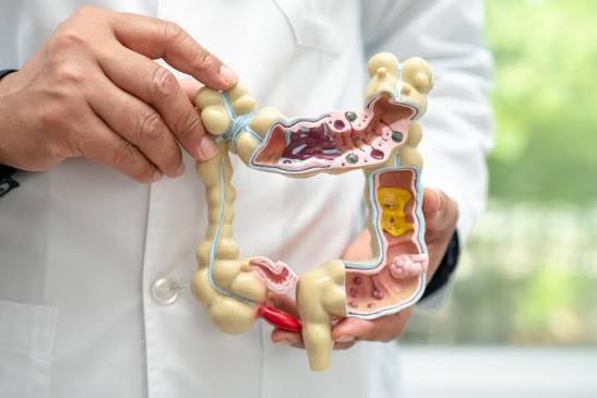 Saúde anuncia distribuição de testes para rastrear câncer de intestino